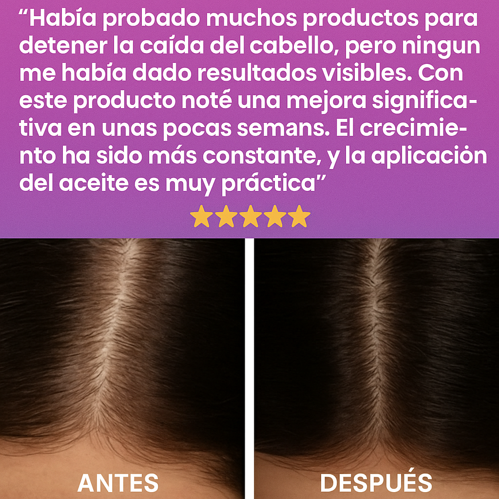 Terapia de Cuero Cabelludo con Luz Roja