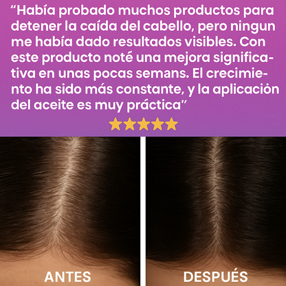 Terapia de Cuero Cabelludo con Luz Roja