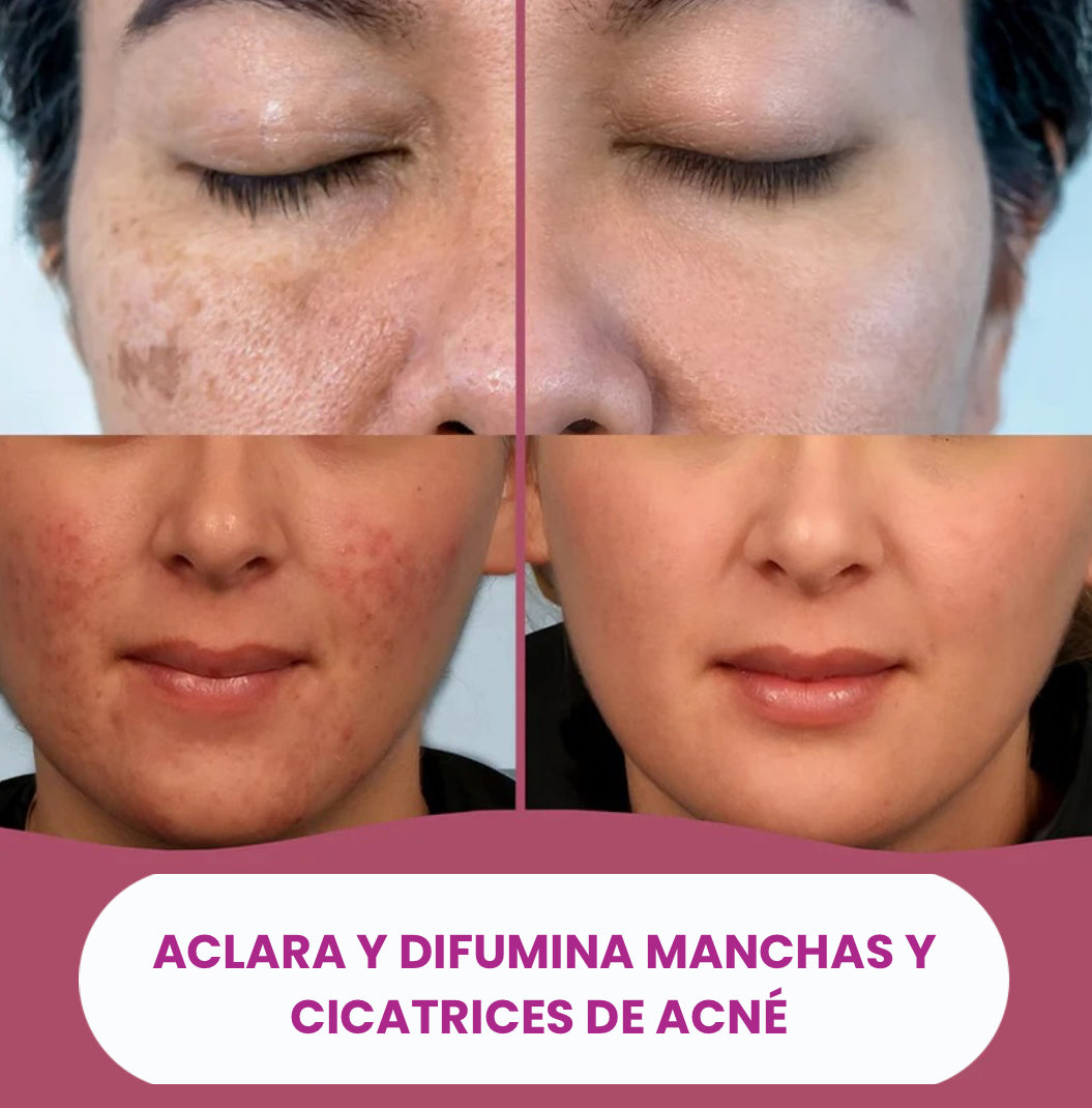 Almohadillas Aclarantes de Cúrcuma y Ácido Kójico