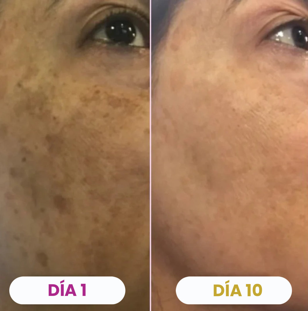 Almohadillas Aclarantes de Cúrcuma y Ácido Kójico