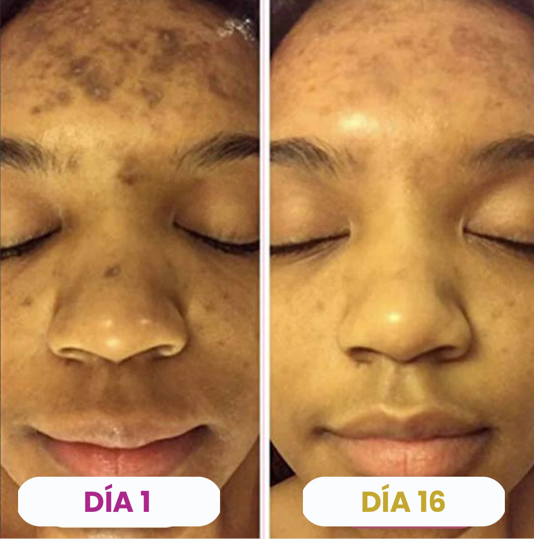 Almohadillas Aclarantes de Cúrcuma y Ácido Kójico