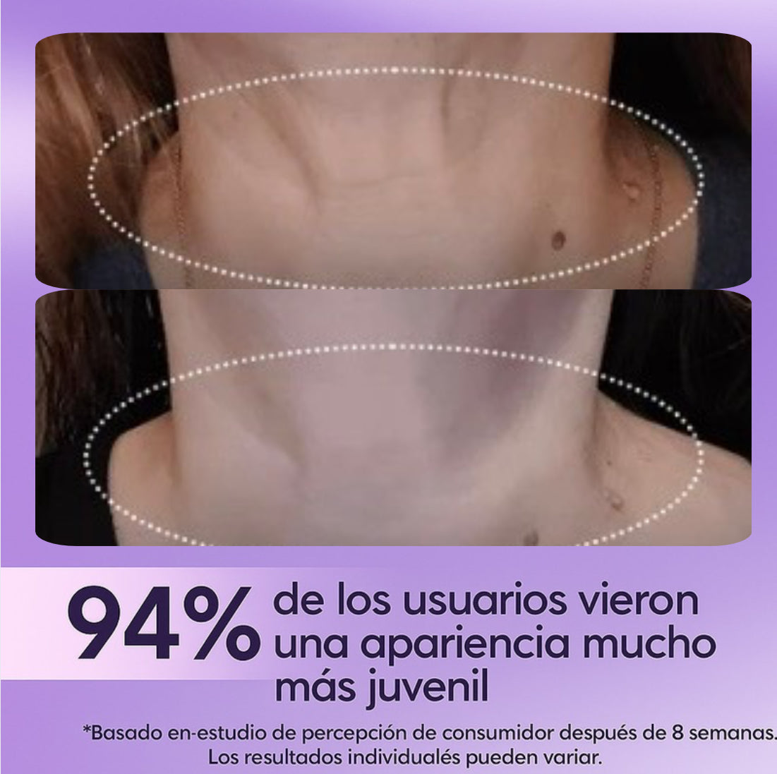 La crema tensora para cuello #1 en el mercado: ¡Siéntete segura!