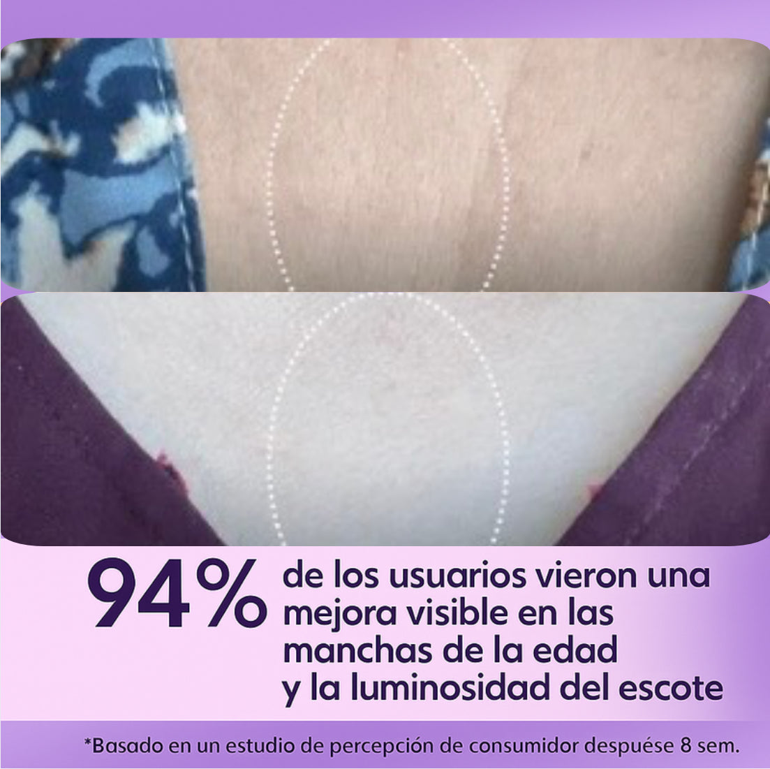 La crema tensora para cuello #1 en el mercado: ¡Siéntete segura!