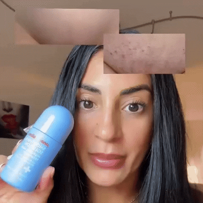 Peach Slices Roll™ - Tratamiento post depilación