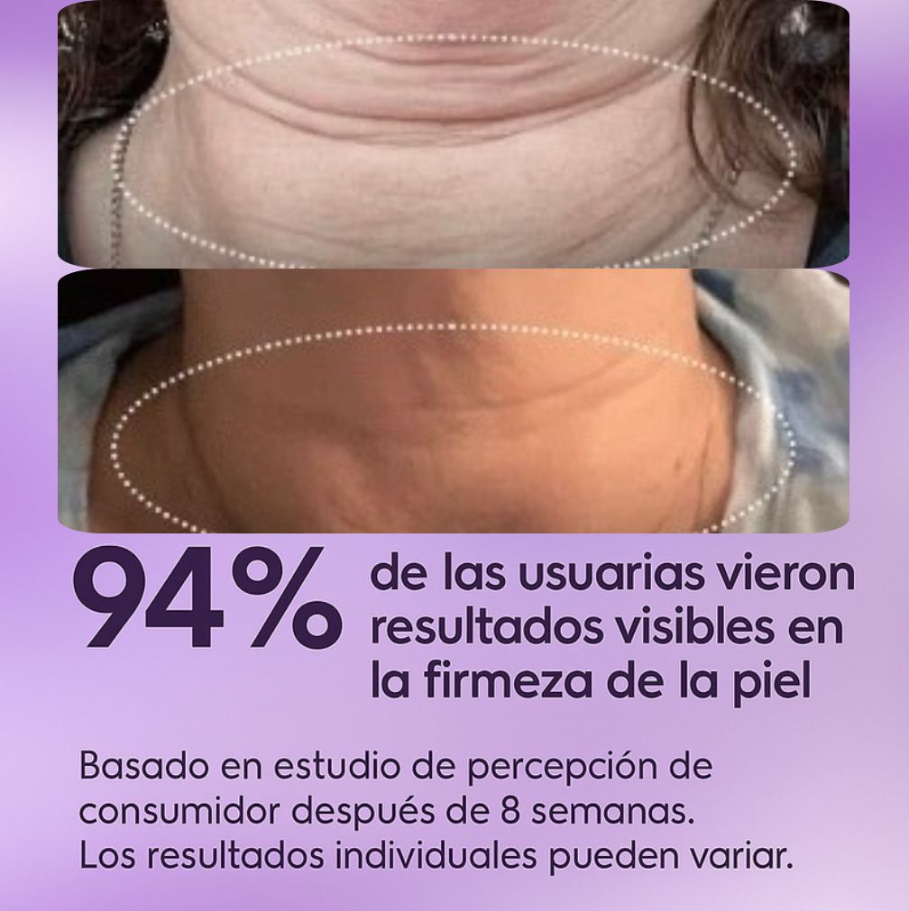 La crema tensora para cuello #1 en el mercado: ¡Siéntete segura!