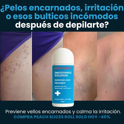Peach Slices Roll™ - Tratamiento post depilación